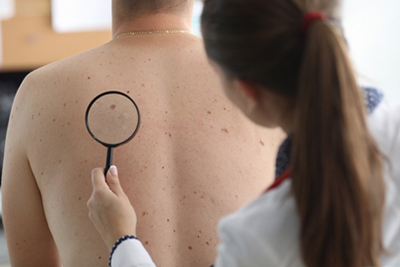 Skin-Cancer-Screening-in-Stuart-FL